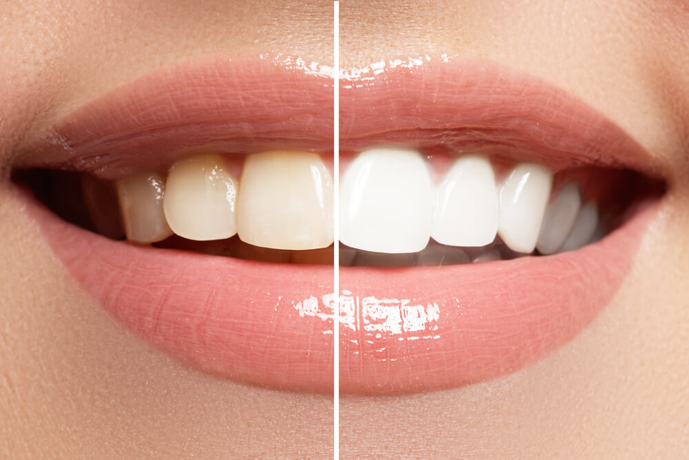 Agrawal Dentist Satellite - Medical & Healthcare photo 5